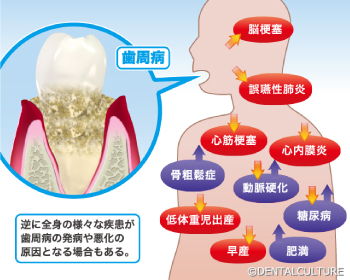 全身に及ぼす影響